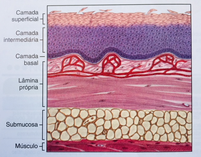 Mucosite - Odontologia Hospitalar - Dra Mabel Diana